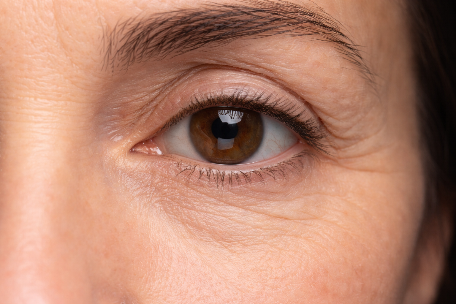 Fine Lines / Wrinkles